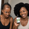 Jelous-woman Procapil Hair Growth Extracts